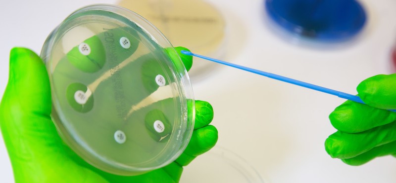 Petri dish