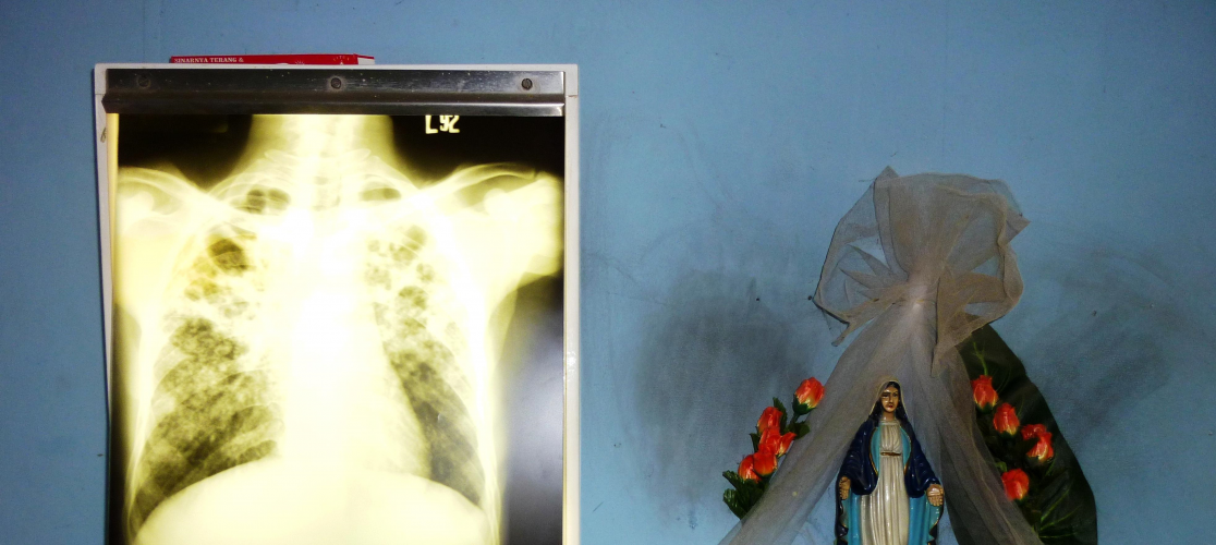 Anthea_CXR in clinic, Dili, Timor Leste