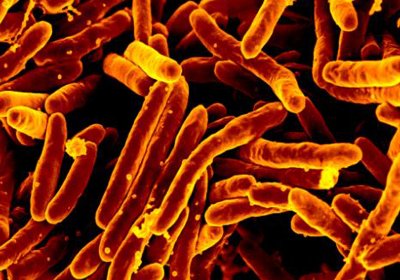 Bacteria