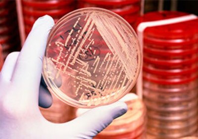 a Scientist holding  a petri dish 
