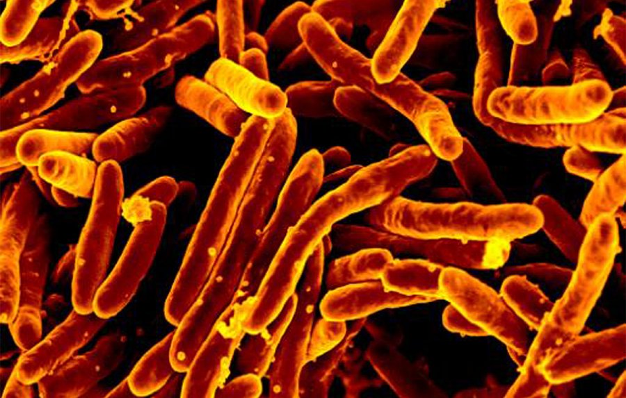 Bacteria
