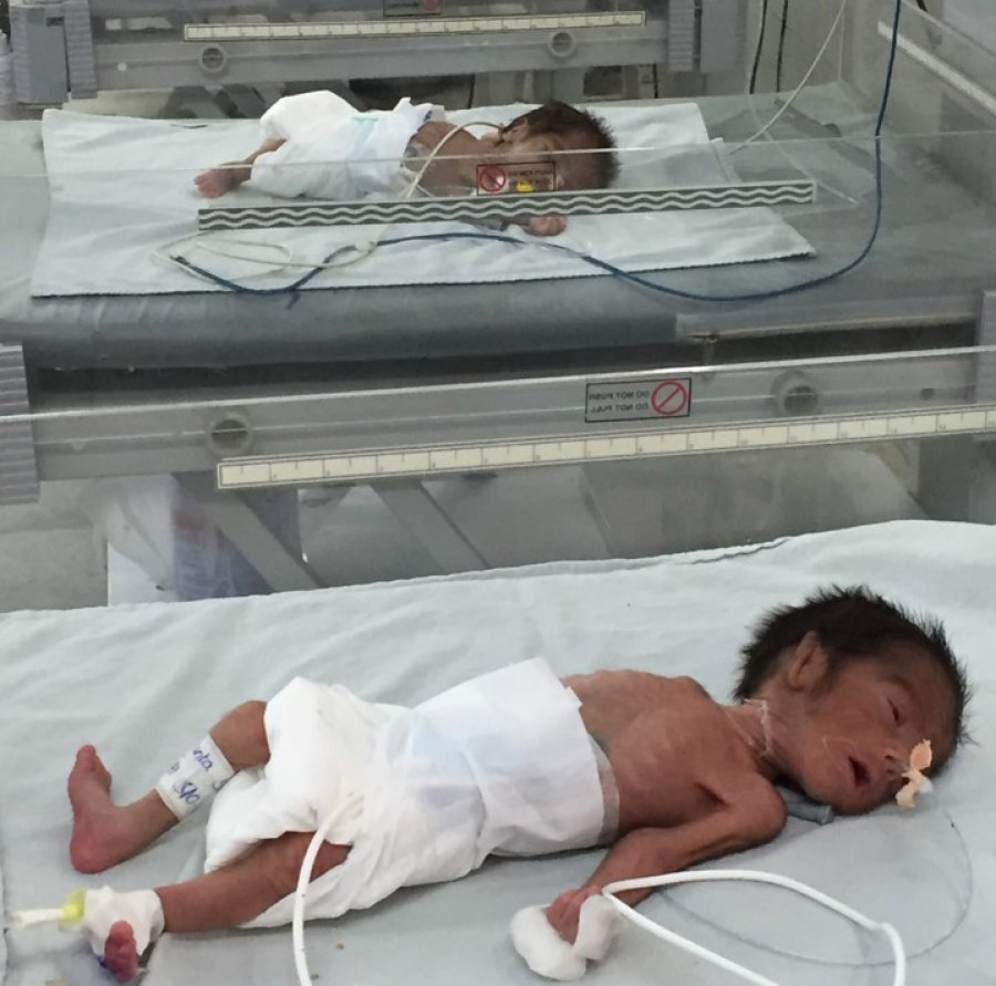 premature babies
