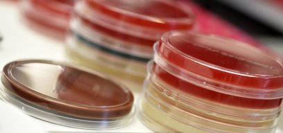 Petri dish